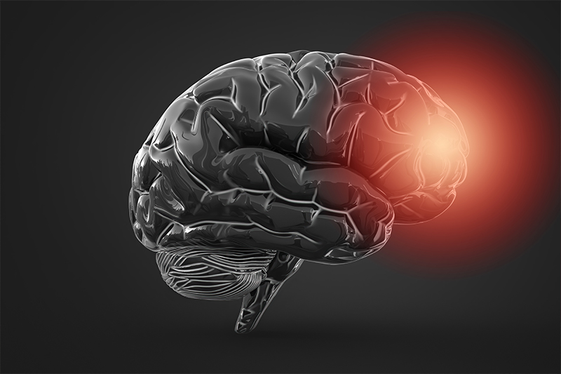 A Major Cause of Dementia Has Been Identified and Could Lead To New Treatments